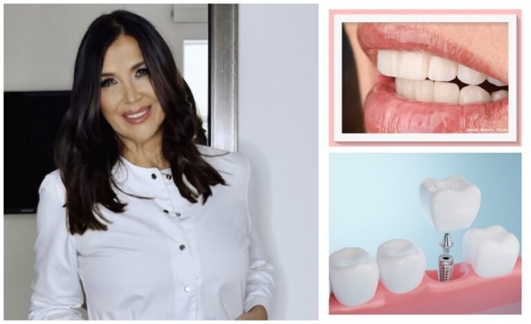 Izgubili ste zub? Ne očajavajte! Dr. Tatjana Knego u kolumni za Cover Style otkriva sve prednosti implantata, ali i 5 razloga zbog kojih ne bi trebali izbjegavati zahvat