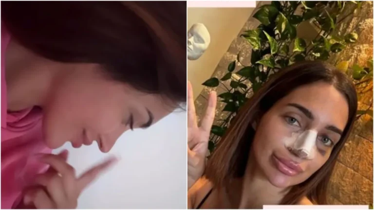 Laura za RTL.hr o oporavku nakon operacije: 'Ljudi kažu 'plastična' kao uvredu, ja bih to više nazvala ogromnom voljom i posvećenosti'