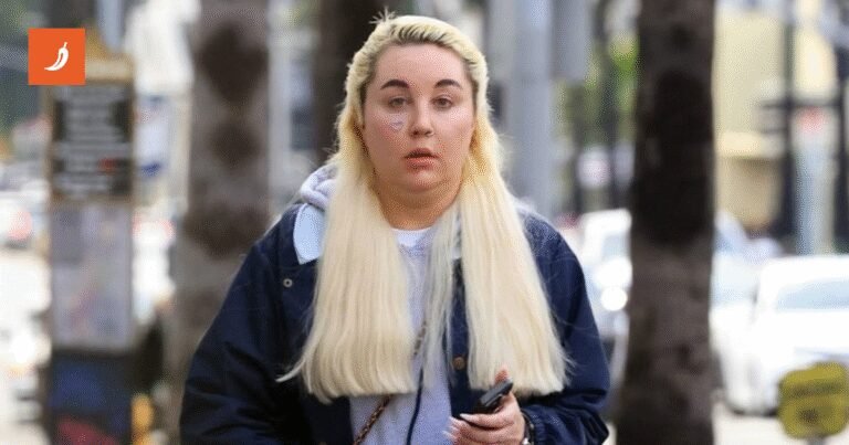 Posrnula dječja zvijezda koristi Ozempic: “Ne želim da mi se vidi podbradak”