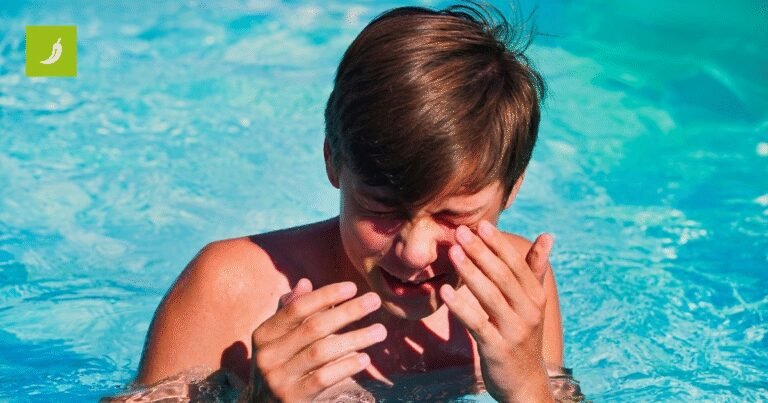 Oftalmolozi upozoravaju: Klor iz bazena može trajno oštetiti oči