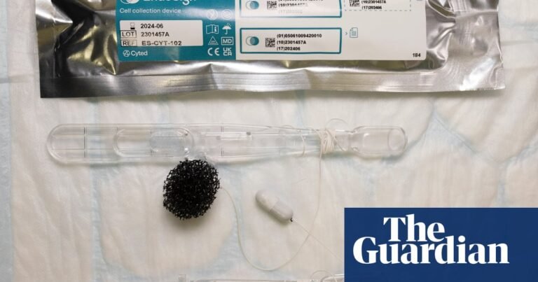 NHS pharmacies to pilot ‘sponge on a string’ test to spot cancer precursor | NHS